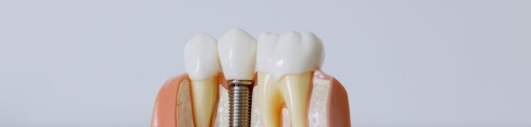 Detailed dental implant model showcasing teeth structure for educational purposes.